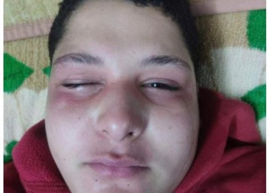 مستوطن يعتدي على طفل بغاز الفلفل في حوارة جنوب نابلس