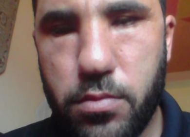 نداء استغاثة أخير قبل أن أفقد نظري