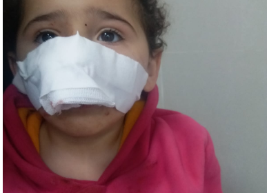  ميار، وشام، ونورة يعانين من نزيف متواصل بحاجة لمن يساعدهن في تغطية تكاليف علاجهن 